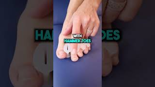 Do Toe Spacers Really Work foothealth painfree healthtips bobandbrad shorts toes [upl. by Joletta]