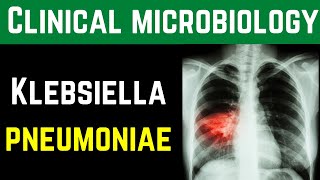 Klebsiella Pneumoniae Clinical Pathogenesis Investigations Treatment Prevention  Dr MubasharAta [upl. by Wardieu89]