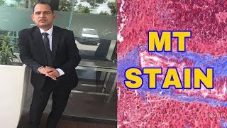 HOW TO DO MT STAIN [upl. by Archibold]