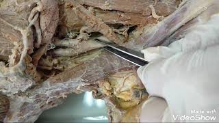 Carotid triangle dissection video [upl. by Handbook]