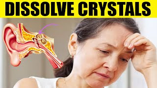 How to Dissolve Crystals in the Inner Ear and Get Rid of Vertigo [upl. by Rolfe874]