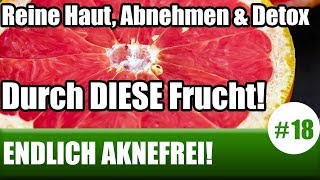 Reine Haut Abnehmen und Detox durch DIESE Frucht ENDLICH AKNEFREI 18 [upl. by Eirojam493]