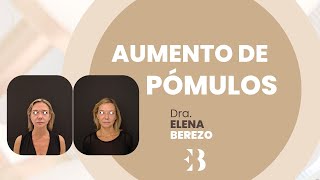 Antes y después de aumento de pómulos  Clínicas EB [upl. by Ennaitsirk]