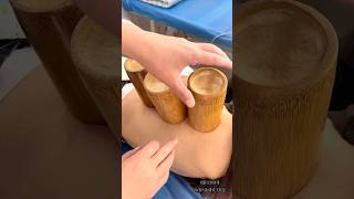 Cupping therapy restores health cuppingtherapy food relax satisfying massage [upl. by Aruasi]