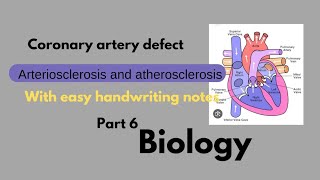 coronary Artery Defect l arteriosclerosis atherosclerosis diff l part6 biology [upl. by Mott223]