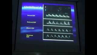 Fetal doppler  Dr Hussein Abo El Makarem [upl. by Allesor]