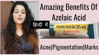 Azelaic Acid  Benefits amp Side effects AzelaicAcid aziderm pigmentation hyperpigmentation acne [upl. by Tnaryb35]