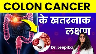 Colon Cancer Kya Hai Kyu Hota Hai Causes amp Symptoms of Colon Cancer in Detail [upl. by Theressa]