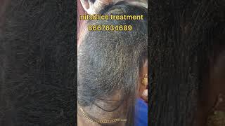 nits hair nitsremoval eeru haircare peenu ytshorts nits removal treatment hair problem [upl. by Stanway1]