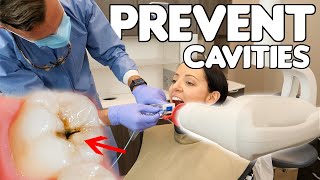 5 Simple Ways To Prevent Cavities [upl. by Luigino]