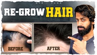 5 Natural Ways To RE GROW Lost Hair🦱 home remedies hair mensfashion [upl. by Portie]