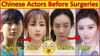 Chinese Actors Before and After Plastic Surgeries 😮  Incredible Changes Chinese Drama [upl. by Disini321]