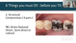 Biomimetic Restorative Dentistry  The six lessons approachDrHaider Waleed biomimetic [upl. by Bernie]