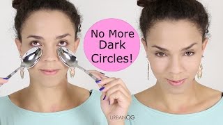 How to Get Rid of Dark Circles and Bags Under Eyes  Puffiness Under Eyes [upl. by Atteyram863]