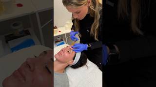 Microneedling  PRP Vampire Facial [upl. by Aid38]