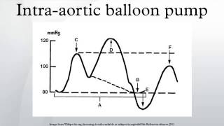 Intraaortic balloon pump [upl. by Ag587]