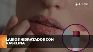 ✅ Protege tus labios del frío  Salud180 🌿 [upl. by Osrick]