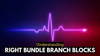 RBBB Uncovered Navigating the Complexities of Right Bundle Branch Blocks [upl. by Ellirpa]