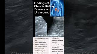 Findings of Chronic Kidney Disease on ultrasound kidney healthytips shortsbeta DrSaimakhan [upl. by Supen197]