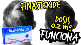 Finasteride DOSIS 1mg se puede REDUCIR a 02 mg  Tratamiento CALVICIE Masculina [upl. by Nilkcaj108]