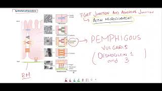 Pemphigus vulgaris vs Bullous pemphigoidEpithelial cell junctions [upl. by Llednohs]