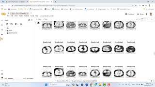 Project Denoising brain tumor using Autoencoder عربى [upl. by Garrison467]