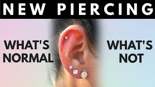 New Piercing Whats Normal Whats Not Things to Look Out For [upl. by Alvis927]