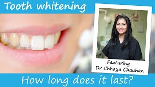 How long does teeth whitening last [upl. by Gnahk]