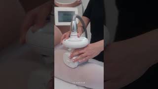 LPG Body Slimming  Firming and AntiCellulite Treatment [upl. by Acinoryt]