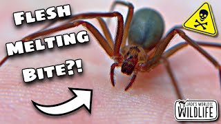 How DEADLY Is The BITE Of The BROWN RECLUSE REALLY [upl. by Leonanie]