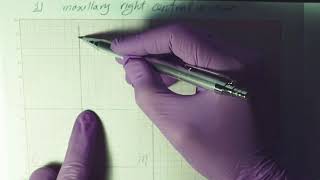 Drawing Permanent maxillary right central incisor Part I [upl. by Erik]