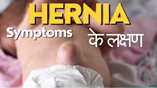 Symptoms of hernia  Hernia ke lakshan  हर्निया के लक्षण  Hernia symptoms in Hindi [upl. by Isayg880]