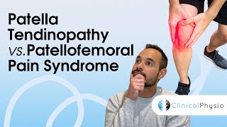 Patella Tendinopathy vs Patellofemoral Pain Syndrome  Expert Physio Guide [upl. by Janette364]