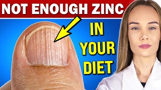 13 signs of zinc deficiency you should NOT ignore AND WHAT TO DO [upl. by Einaffets]