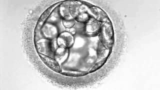 Development of hatching Embryo blastocyst stage [upl. by Brigham]