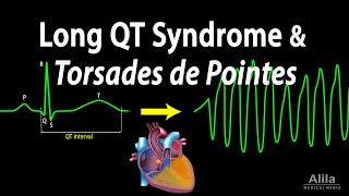 Long QT Syndrome and Torsades de Pointes Animation [upl. by Valene883]