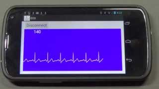 ECGBluetooth [upl. by Normandy]