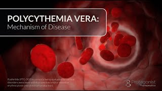 Polycythemia Vera Mechanism of Disease [upl. by Tabb]