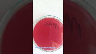 Bacterial culture  Bacterial growth on Media  Microbiology  Culture sensitivity test [upl. by Nosrej665]