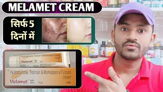 Melamet cream use dose benefits and side effects full review in hindi [upl. by Nwahsear]