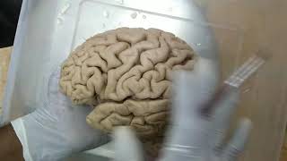 Cerebrum  specimen demo [upl. by Ul]