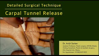 Carpal tunnel release Detailed surgical technique I Carpal tunnel syndrome I Avijit Plastic Surgery [upl. by Fish]