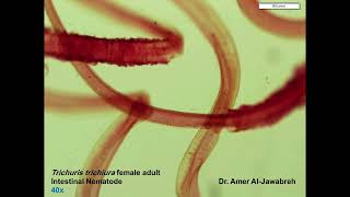 Trichuris trichiura Adult Female Intestinal Nematode [upl. by Willette]