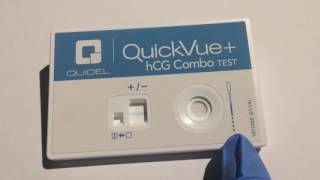 URINE PREGNANCY LIVE TEST  Quick Lab test [upl. by Newlin411]