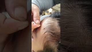 cover satisfying edsheeren hairstyle edsheeranperfect hair haircare music blackheads [upl. by Astred]