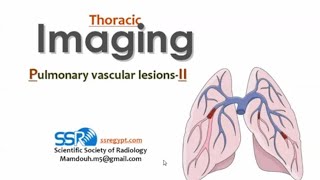 Imaging of Pulmonary vascular lesions II DRE Prof Mamdouh Mahfouz [upl. by Dahsraf267]