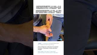 Scaphoid Tubercle Tenderness Test  Scaphoid Fracture Diagnosis [upl. by Abraham351]