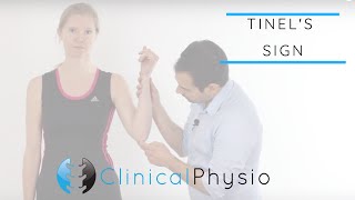 Tinels Test for Cubital Tunnel Syndrome  Clinical Physio [upl. by Yartnod]