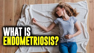 What Is Endometriosis [upl. by Feldman694]