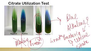 Citrate Test [upl. by Burch]